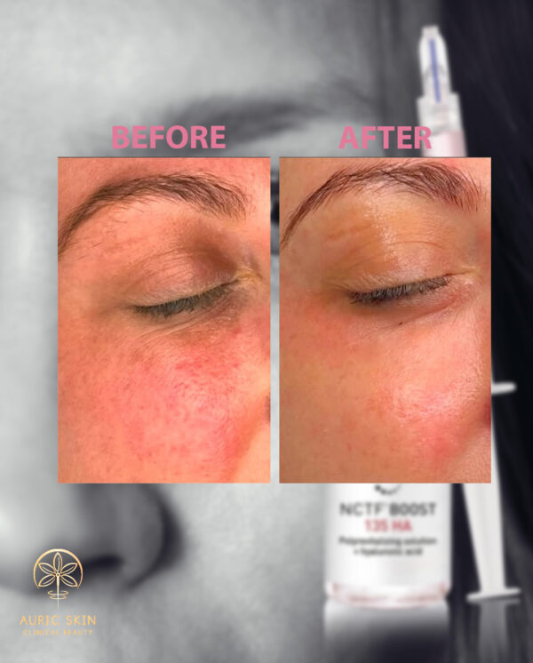 NCTF-Before-and-after-image-04