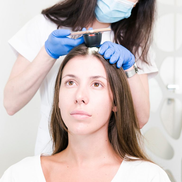 Exosomes-Therapy--Scalp-Alopecia